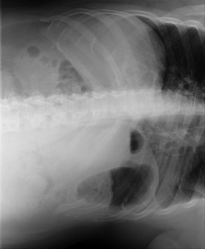 2022 Chest Xrays-CT.1275.P0000001.ST000001.SE00.jpg
